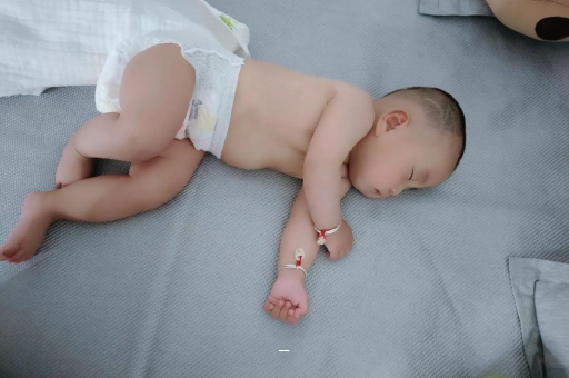 三河宝宝脸上有白色斑块